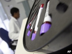FILE - Blood is tested at the AIDS Care Training and Support Initiative (ACTS) at White River Junction, South Africa, in December 2008. The center is partly funded by the President's Emergency Plan for AIDS Relief.