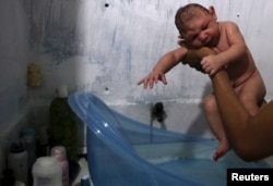FILE - Daniele Santos, 29, holds her son Juan Pedro who was born with microcephaly, after bathing him at their house in Recife, Brazil, Feb. 9, 2016.
