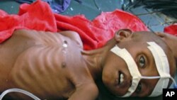 UNICEF Airlifts Emergency Nutritional Supplies to Drought Affected Children in Southern Somalia.