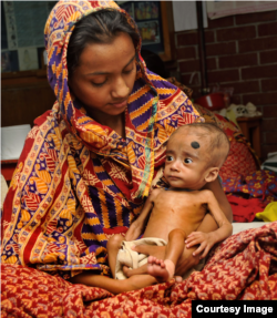 A Bangladeshi mother holds her child, who was treated for malnutrition at the International Centre for Diarrhoel Disease Research in Dhaka.(Photo by Rabiul Hasan/International Centre For Diarrhoeal Disease Research)