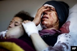 FILE - Aida, 32, reacts as she recovers from severe injuries after the Syrian Army shelled her house in Idlib, northern Syria.
