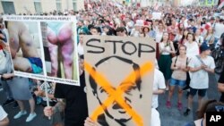People carry a poster showing photos of protesters allegedly beaten by police, left, and a caricature depicting Belarusian President Alexander Lukashenko, during an opposition rally in Minsk, Belarus, Aug. 17, 2020.