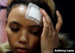 Gabriella Engels touches her head during a media conference in Pretoria, South Africa, Aug. 17, 2017.
