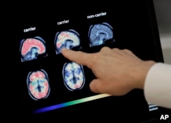 FILE - A physician reviews a brain scan at Banner Alzheimer's Institute in Phoenix, Arizona, Aug. 14, 2018.