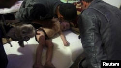 Seorang anak menerima perawatan di sebuah rumah sakit di Douma, bagian timur Ghouta, dekat Damaskus, Suriah, setelah serangan yang diduga menggunakan senjata kimia, 7 April 2018. (Helm Putih via Reuters) 