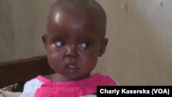 Un enfant malnutri à l'hôpital de référence de Minova, Nord-Kivu, RDC, 13 février 2018. (VOA/Charly Kasereka)