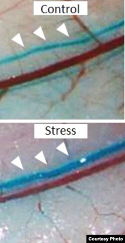 Image of green spheres flowing through lymph vessels of mice that are not stressed (top) or stressed (bottom) (Le et al., Nature Communications)